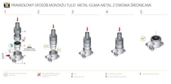 TedGum 00394760 Mounting, differential 00394760: Buy near me in Poland at 2407.PL - Good price!