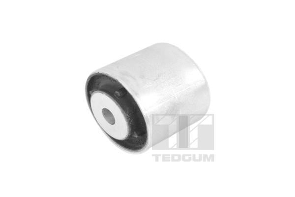 TedGum TED41771 Mounting, differential TED41771: Buy near me in Poland at 2407.PL - Good price!